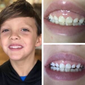 Safe whitening toothpaste